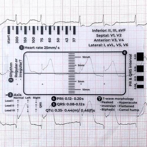 MediTrack – Professional ECG Assessment Pocket Guide
