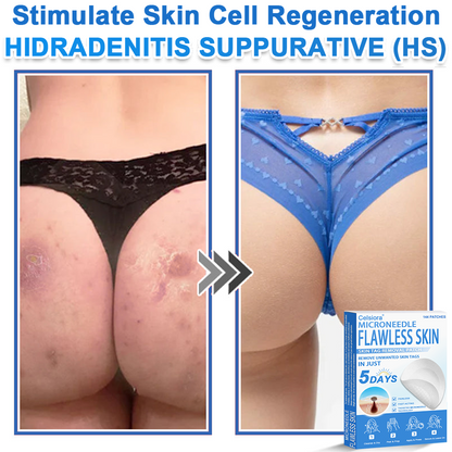 GlowSkin - 2-in-1 Microneedle & Hydrocolloid Star Patch