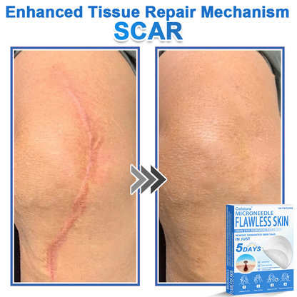 GlowSkin - 2-in-1 Microneedle & Hydrocolloid Star Patch