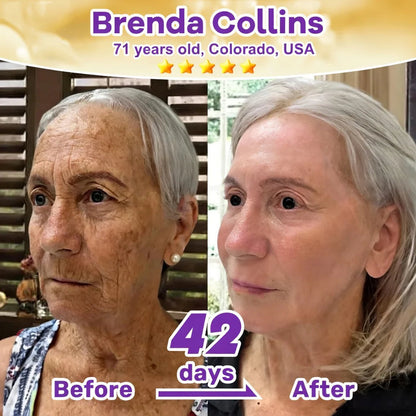 SkinRevive – Biotin 10-in-1 Skin Restoration Cream