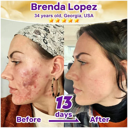SkinRevive – Biotin 10-in-1 Skin Restoration Cream