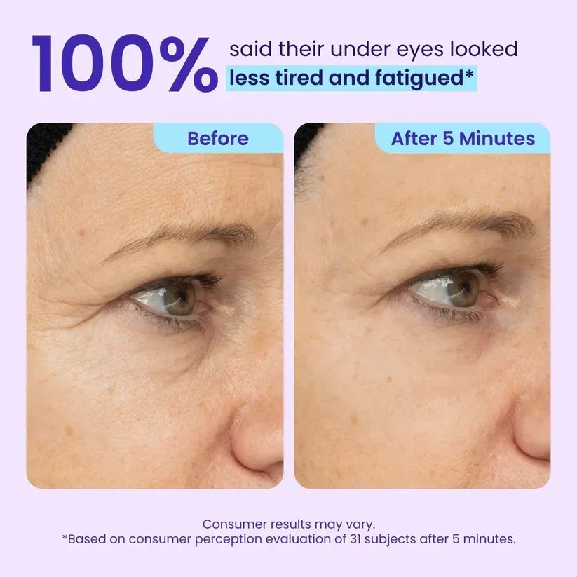 LumeGlow – Refreshing Rapid Reduction Eye Serum