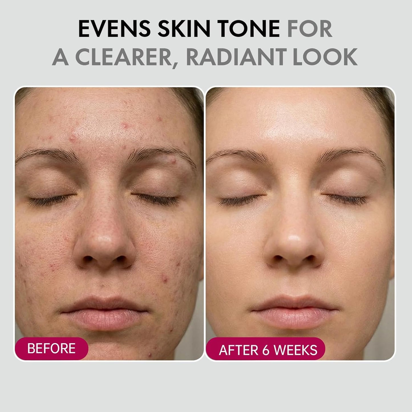 DermaGlow – Advanced Skin Renewing Treatment Cream