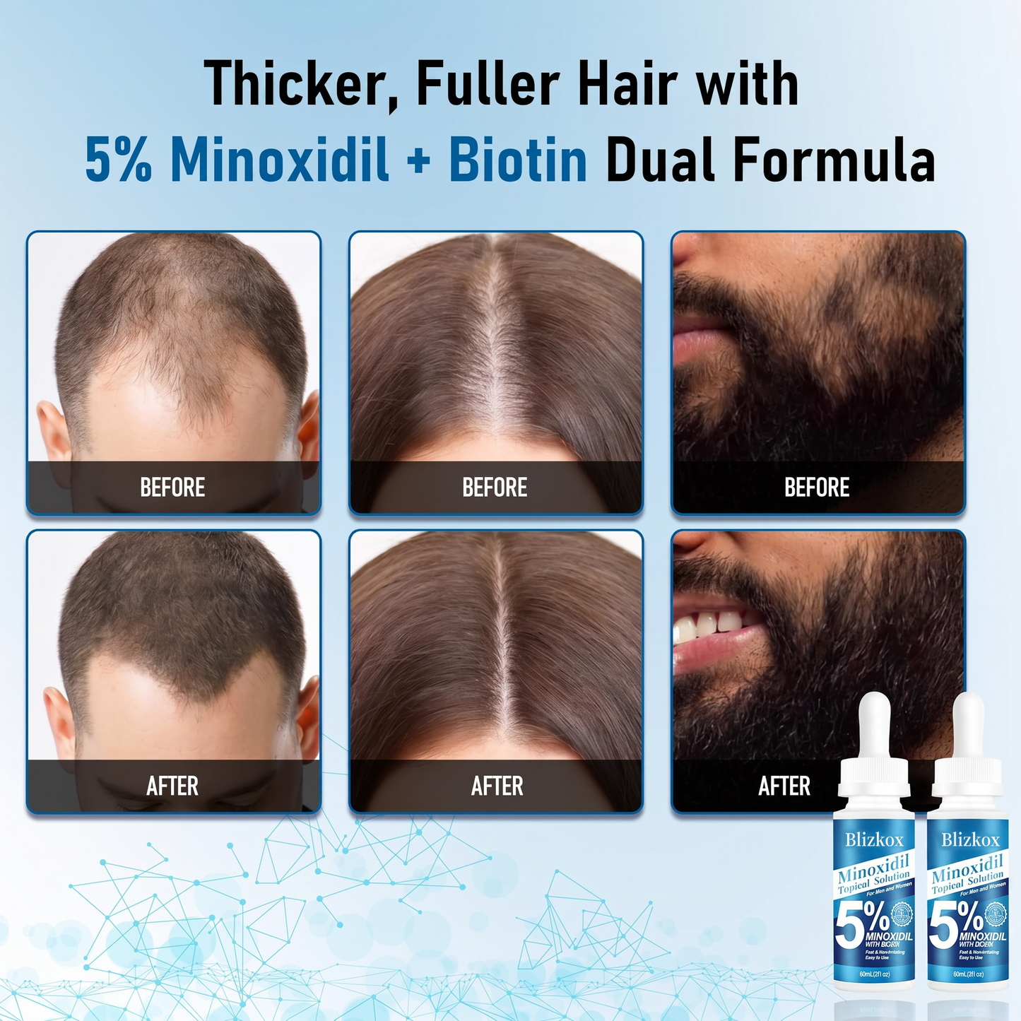 GrowthElite – Biotin Infused Hair Regrowth Formula