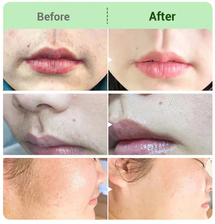 DermaSilk – Sensitive Skin Hair Cream