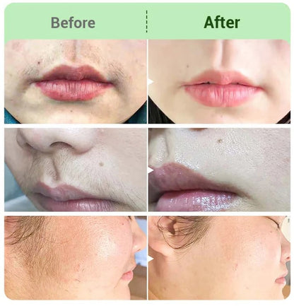 DermaSilk – Sensitive Skin Hair Cream