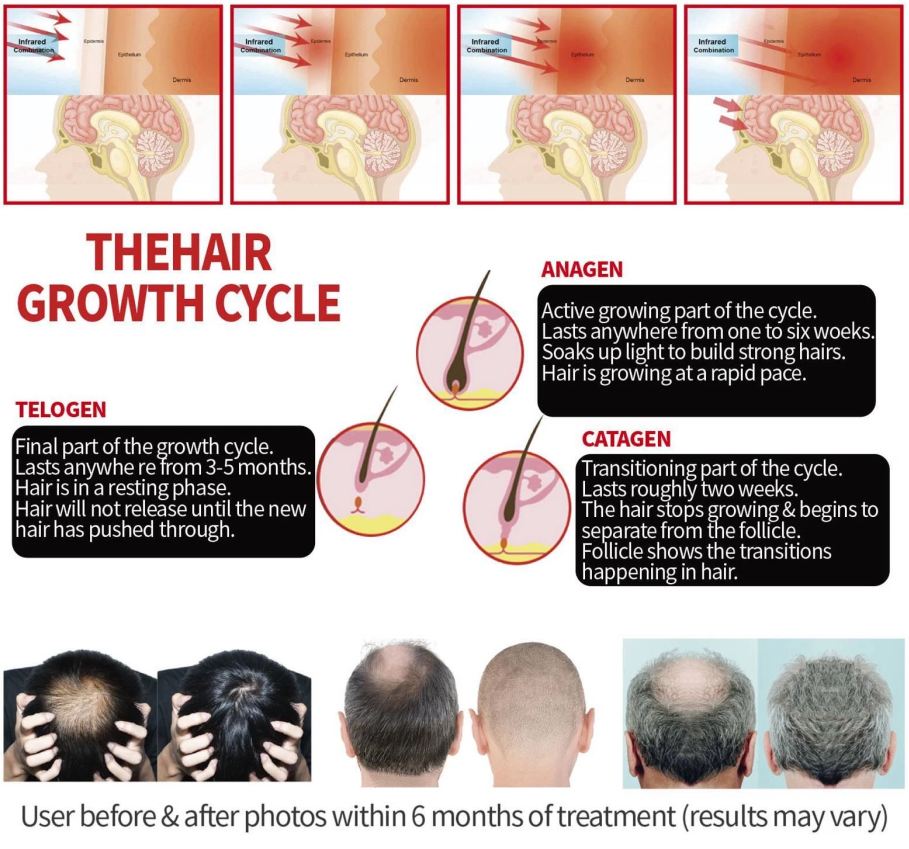 HairLuxe – Multi Mode Hair Wellness Cap