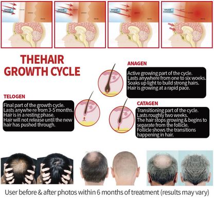 HairLuxe – Multi Mode Hair Wellness Cap