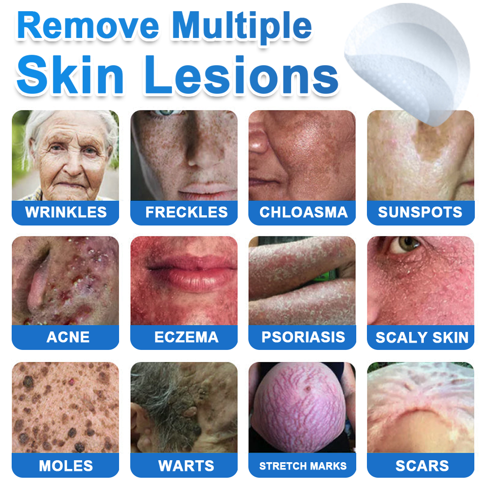 GlowSkin - 2-in-1 Microneedle & Hydrocolloid Star Patch