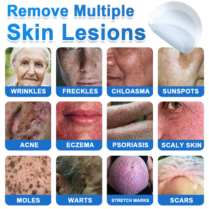 GlowSkin - 2-in-1 Microneedle & Hydrocolloid Star Patch