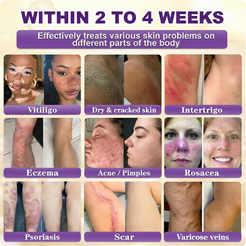 SkinRevive – Biotin 10-in-1 Skin Restoration Cream