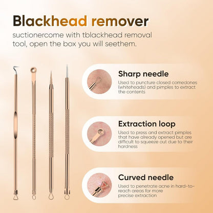 GlowExtract – Rechargeable Blackhead Remover