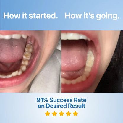 DentiGlow – Fluoride Free Tooth Repair Formula