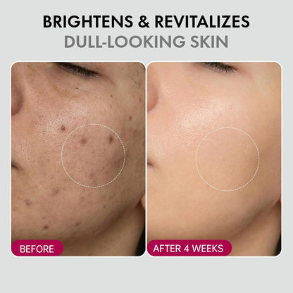 DermaGlow – Advanced Skin Renewing Treatment Cream