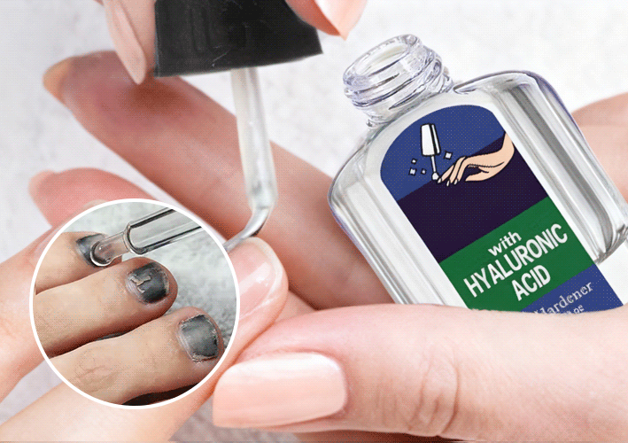 NailRenew - Natural Antifungal Nail Repair Solution