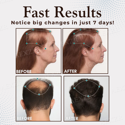 ThriveHair – Premium Hair Growth & Strength Formula