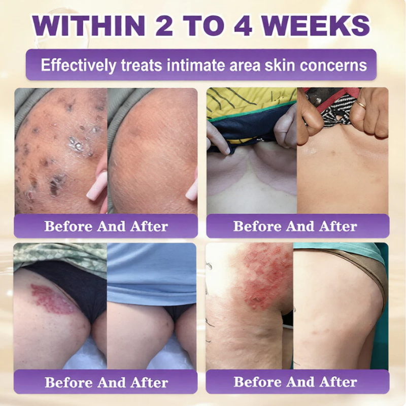 SkinRevive – Biotin 10-in-1 Skin Restoration Cream