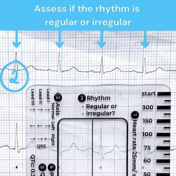 MediTrack – Professional ECG Assessment Pocket Guide