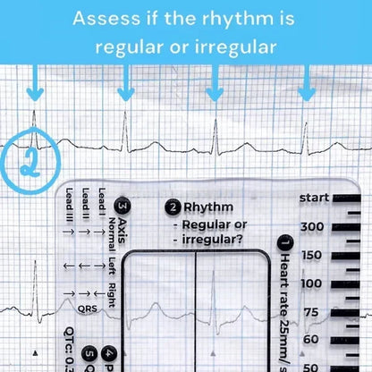 MediTrack – Professional ECG Assessment Pocket Guide