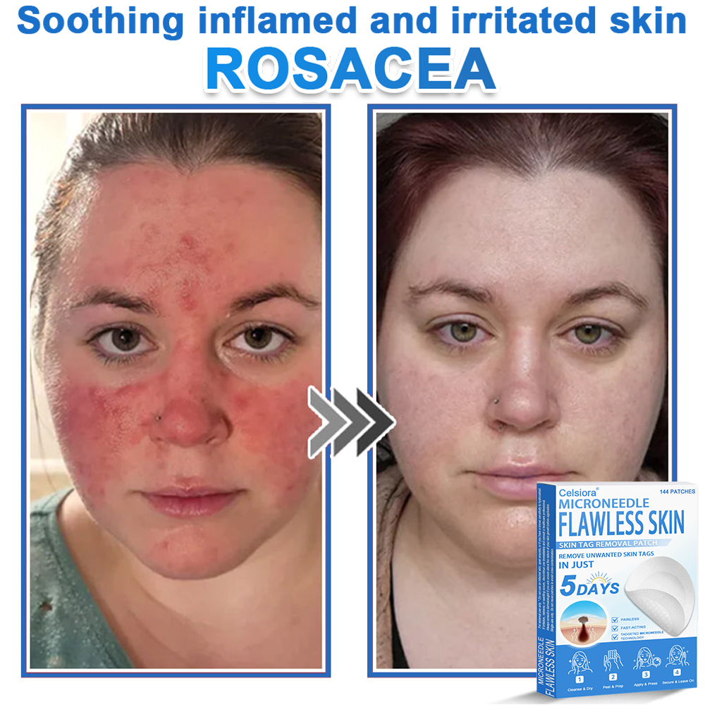 GlowSkin - 2-in-1 Microneedle & Hydrocolloid Star Patch