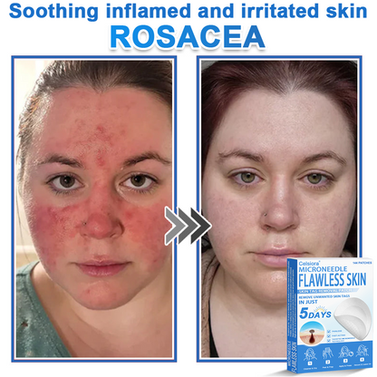 GlowSkin - 2-in-1 Microneedle & Hydrocolloid Star Patch