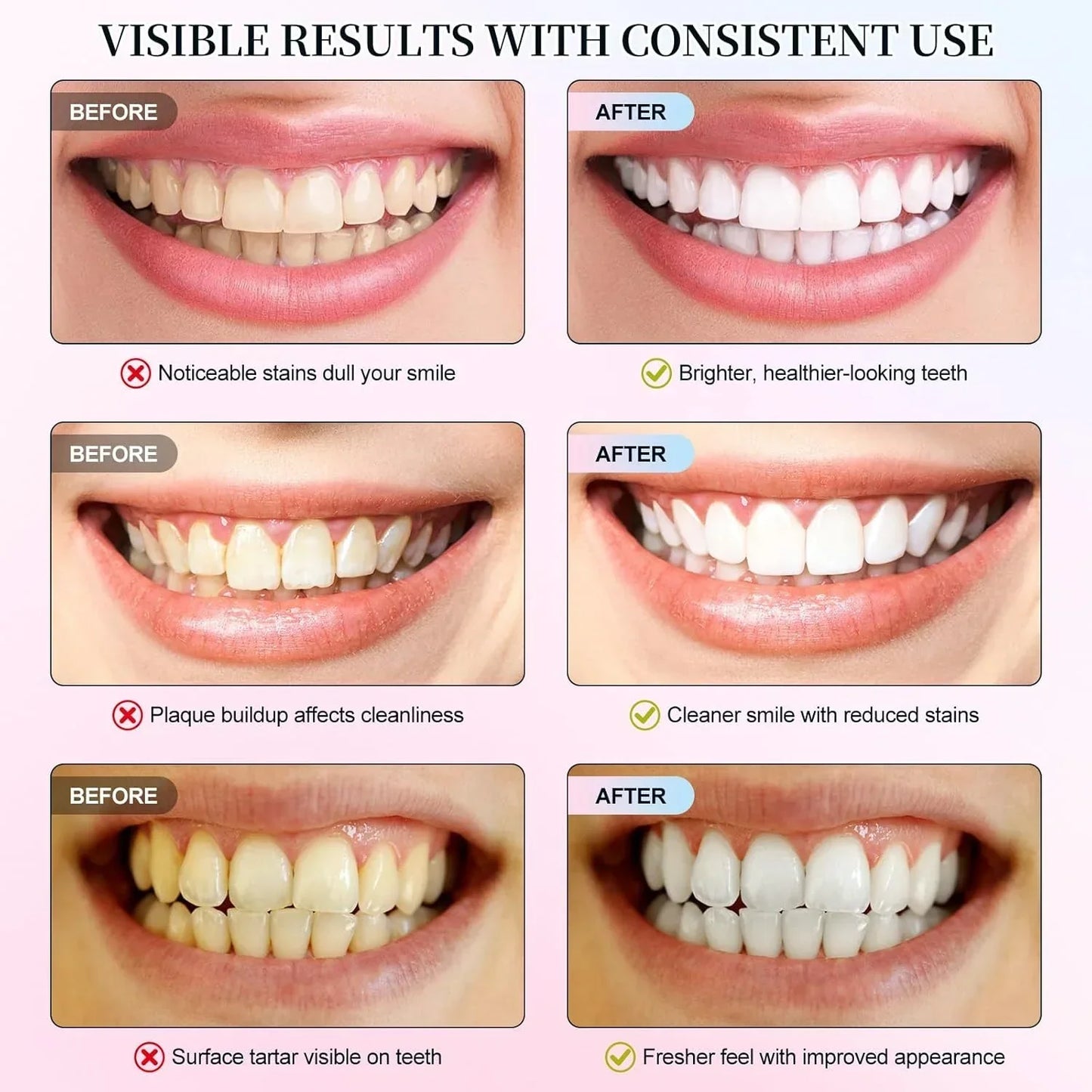 Niacinamide Whitening Toothpaste – Stain Removal & Fresh Breath