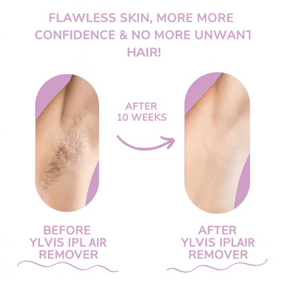 GlowEase - IPL Hair Remover for Effortless Smooth Skin
