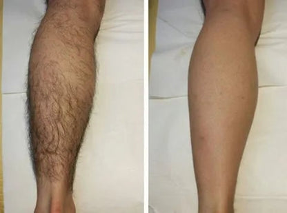 GlowSmooth – Moisturizing Hair Removal Spray