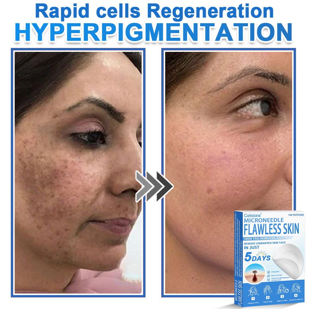 GlowSkin - 2-in-1 Microneedle & Hydrocolloid Star Patch