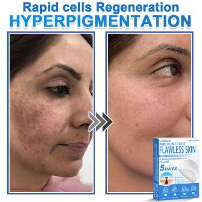 GlowSkin - 2-in-1 Microneedle & Hydrocolloid Star Patch