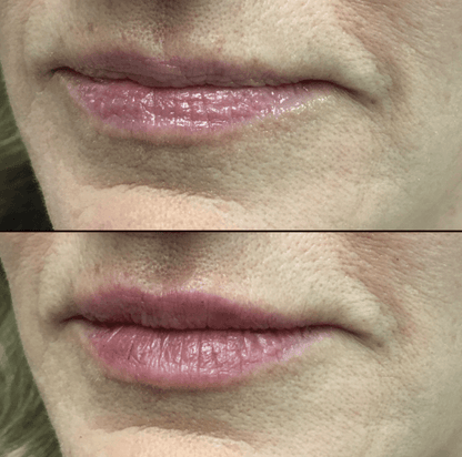 LumiLips – Long Lasting Moisture Lock Lipstick