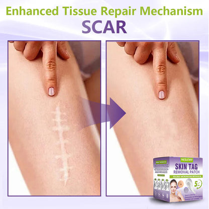 ClearDerma – Microneedle Skin Tag Removal Patch