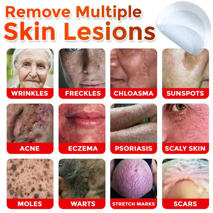 Natrvor –2-in-1 Microneedle Botanical Skin Renewal Patch