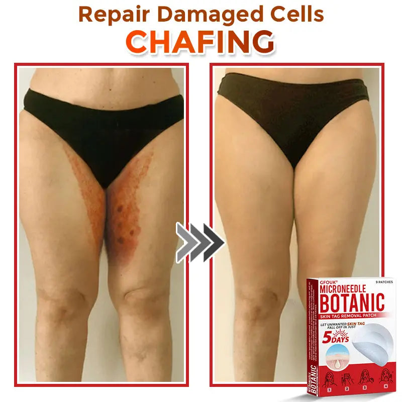 Natrvor –2-in-1 Microneedle Botanical Skin Renewal Patch