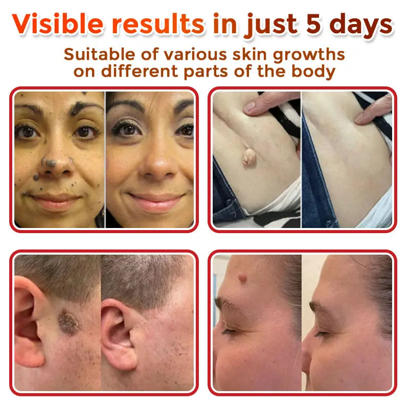 Natrvor –2-in-1 Microneedle Botanical Skin Renewal Patch