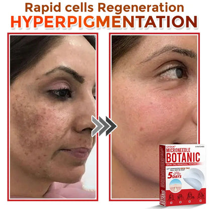 Natrvor –2-in-1 Microneedle Botanical Skin Renewal Patch
