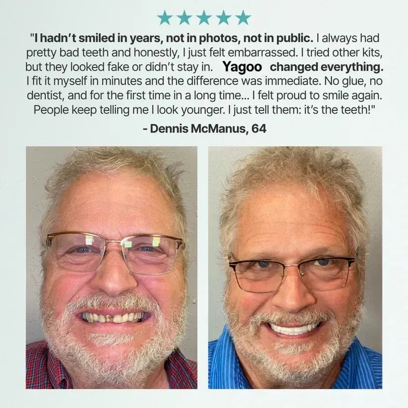 🌎Ends Today: 70% OFF! ⏰Yagoo™ Medical Full Denture with Strong Suctiond🦷Obtain American Dental Association (ADA) Certification