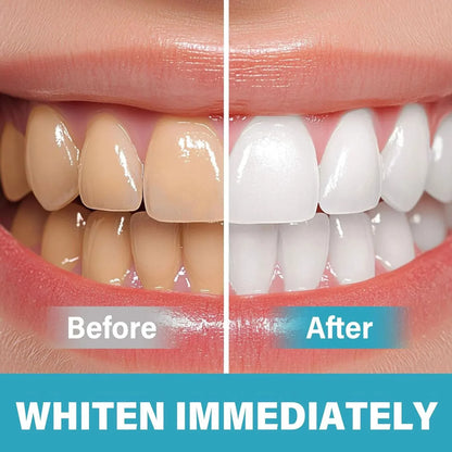 SmileBright- Instant Teeth Whitening Pigment