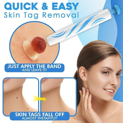 TagGone - Quick & Safe Skin Tag Remover