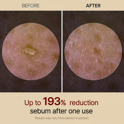 SkinAura – Mild Exfoliating Black Rice Ampoule Serum