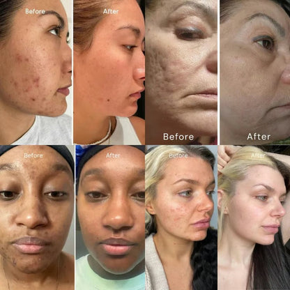 DermaRoll Neck – Sculpting Lift Cream
